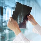 stock-photo-doctor-with-mammography-292061516
